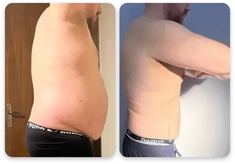Antes e depois — perfil masculino